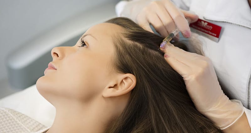 Vlasová mezoterapia stimuluje rast zdravých vlasov